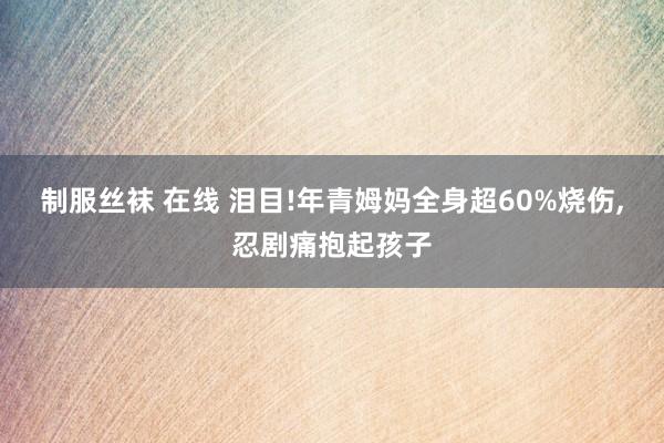 制服丝袜 在线 泪目!年青姆妈全身超60%烧伤,忍剧痛抱起孩子
